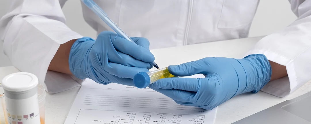 Top Peptides For Metabolic Studies